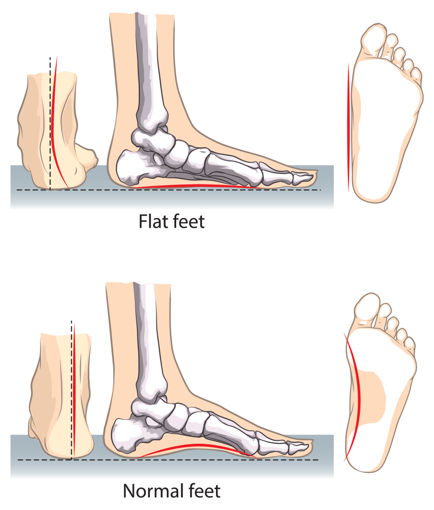 The best shoes for flat feet